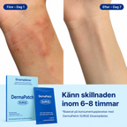 DermaPatch Eksemplåster